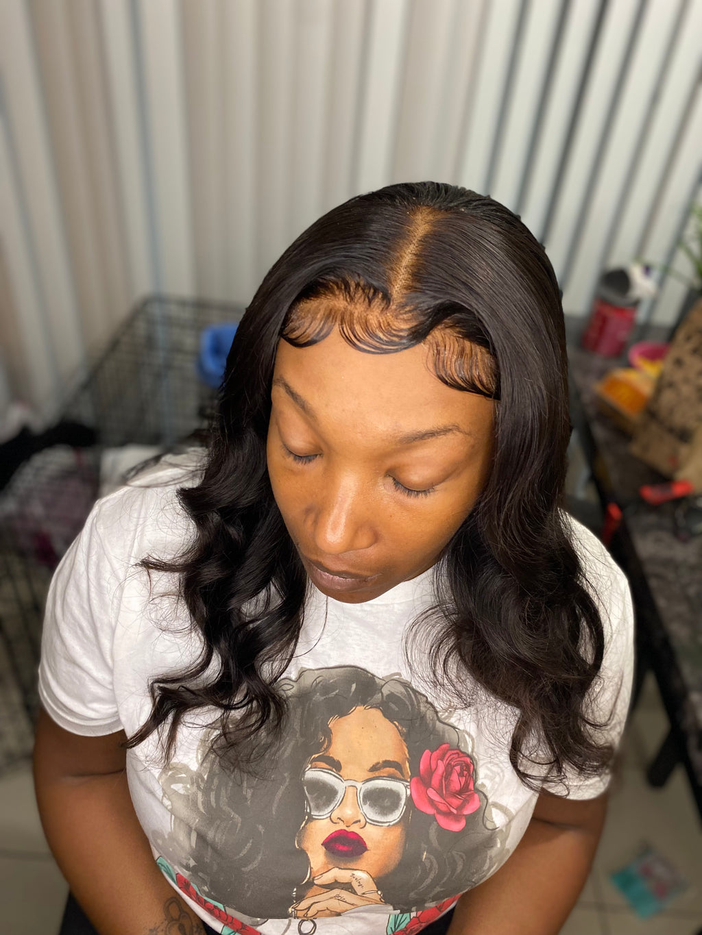 Frontal Install